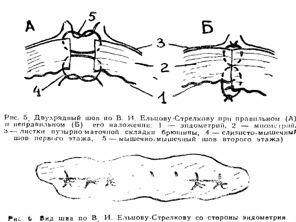 Операция сечения