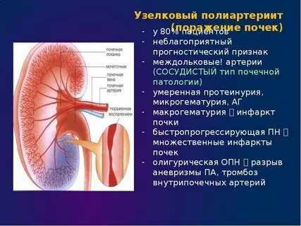 Почечная недостаточность и инфаркт