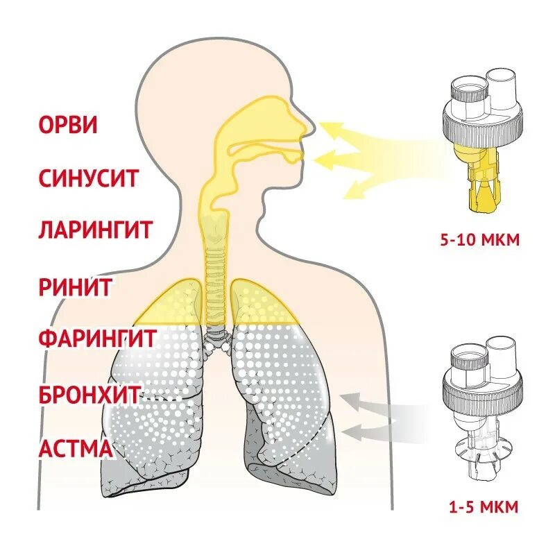 Ингалятор как дышать ртом или носом. Ингаляция схема. Размер частиц в небулайзере. Лекарства через дыхательные пути. Ингалятор детский для бронхита для ребенка.