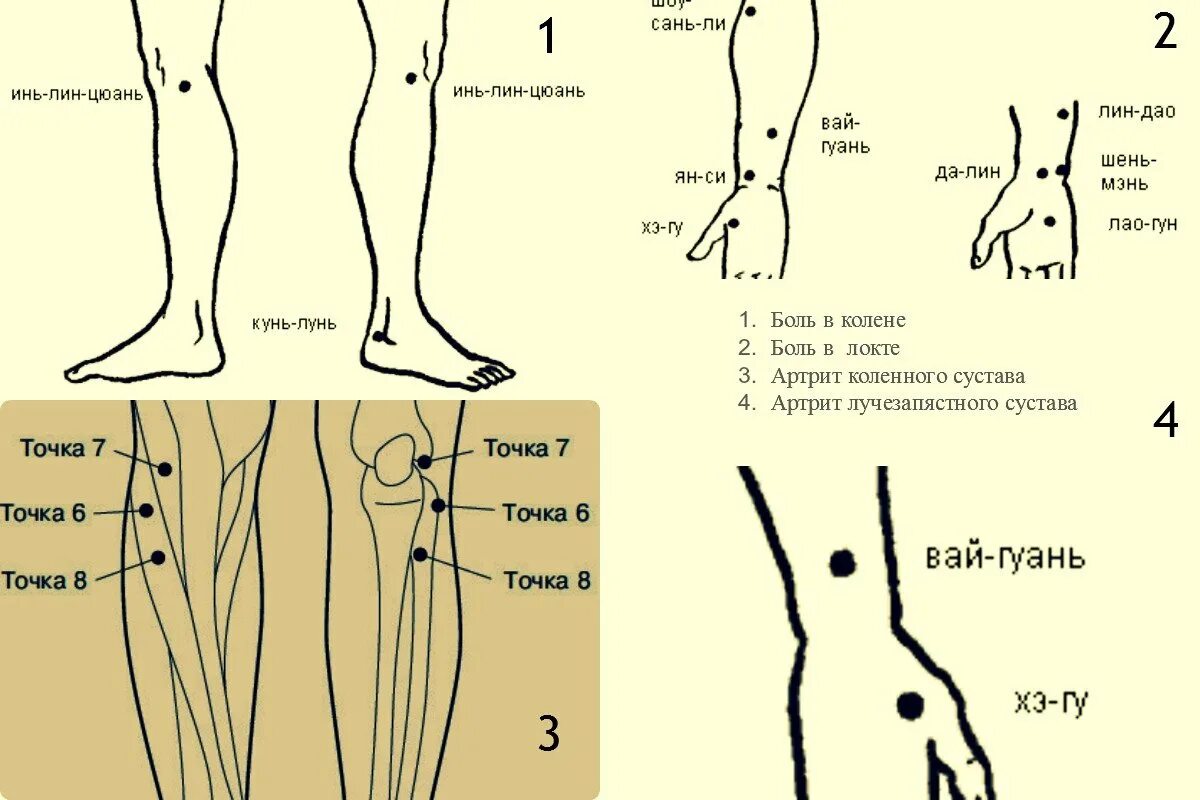 Точки акупунктуры при ревматоидном артрите. Иглотерапия при артритах точки. Точки акупунктуры при боли в колене. Иглоукалывание от ревматоидного артрита.