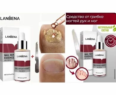 Lanbena от грибка