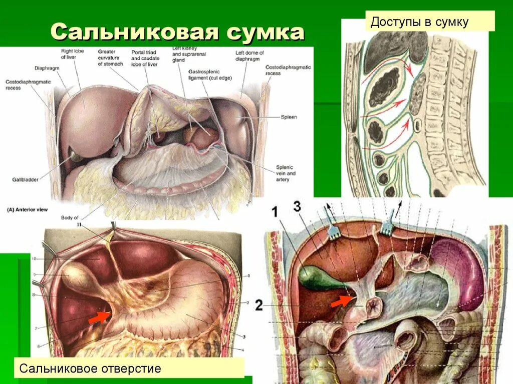 Винслово отверстие. Сальниковая сумка брюшины анатомия. Сумки брюшины топографическая анатомия. Ход брюшины сальниковая сумка. Сальниковая сумка топографическая анатомия стенки.