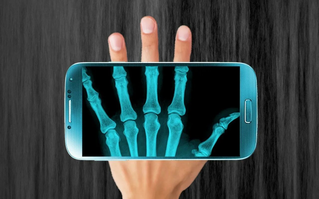 Xray андроид
