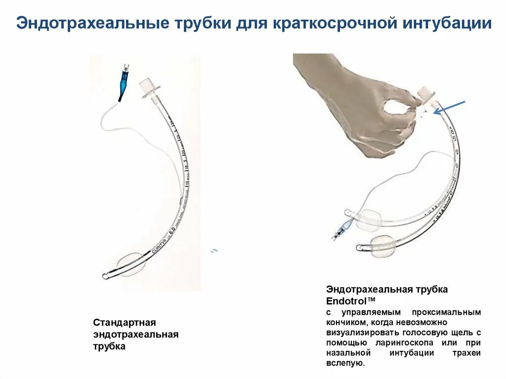 Что такое эндотрахеальный наркоз