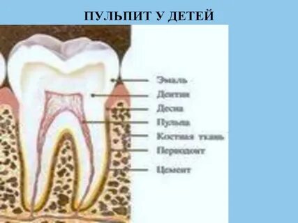 Пульпа у детей