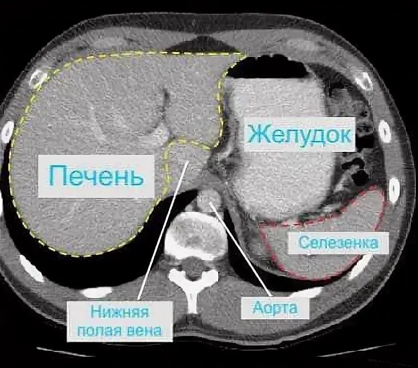 Можно ли кт. Компьютерная томография желудка. Компьютерная томография живота.