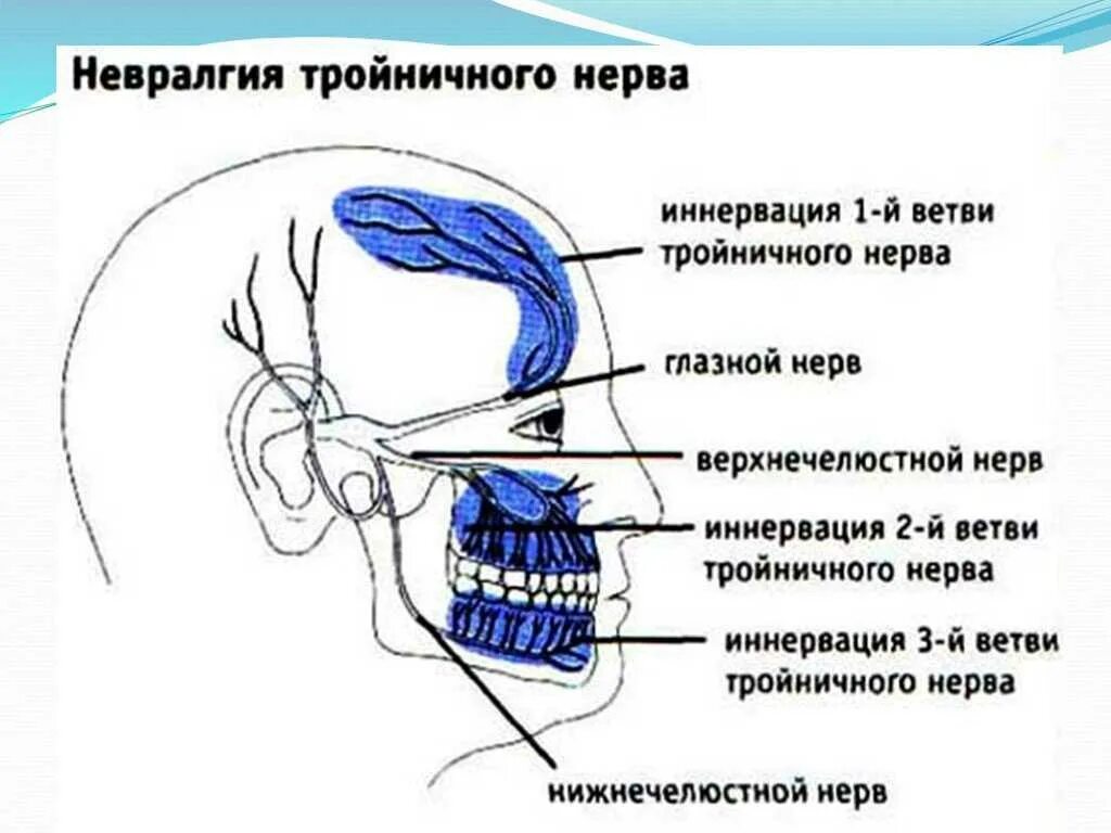 Невралгия 3 ветви тройничного нерва. 1 И 2 ветвь тройничного нерва. Невралгия второй ветви тройничного нерва. Невралгия первой ветви тройничного нерва симптомы. Можно греть тройничный нерв