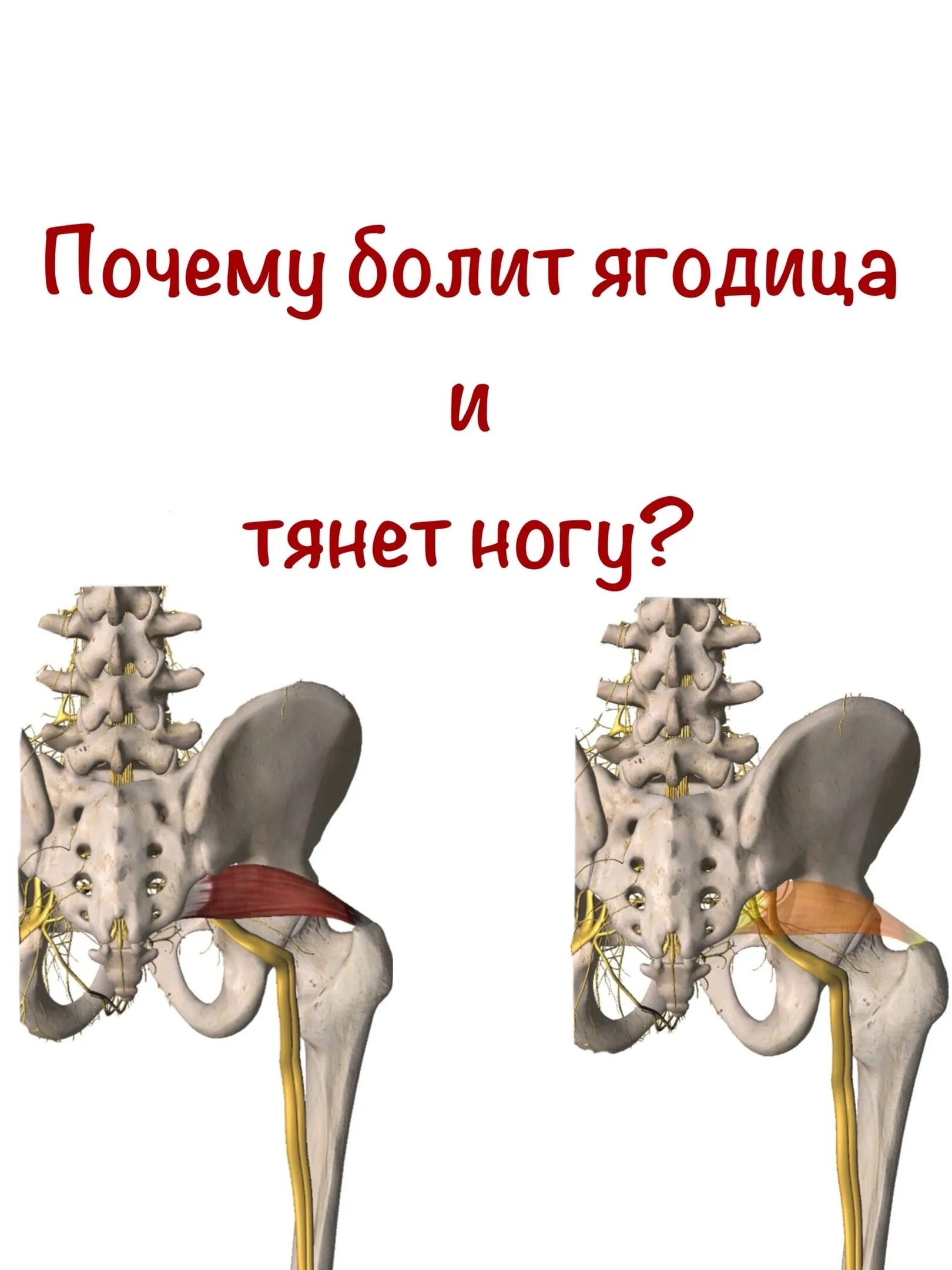 Тянет в ягодице. Тянет в ягодице
