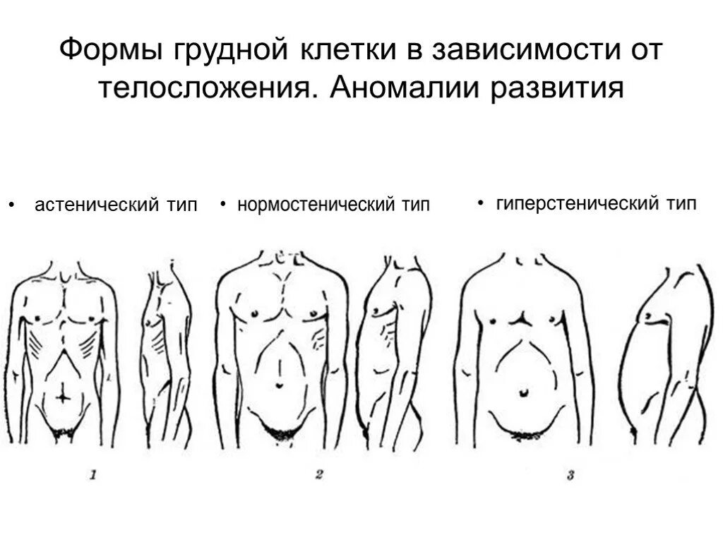 Округлая грудная клетка. Формы грудной клетки в норме и патологии. Астенический нормостенический гиперстенический Тип грудной клетки. Типы патологических форм грудной клетки. Формы грудной клетки нормостеническая астеническая.