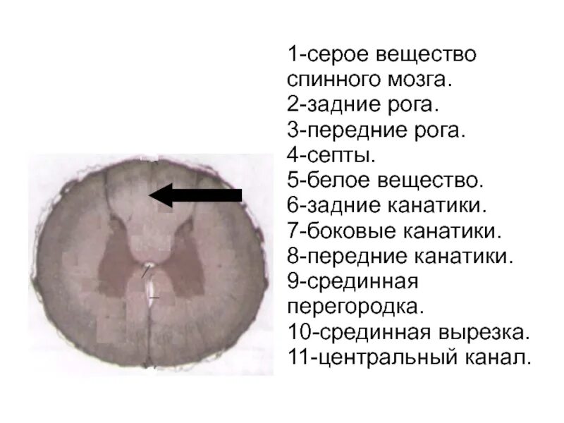 Передние рога серого вещества
