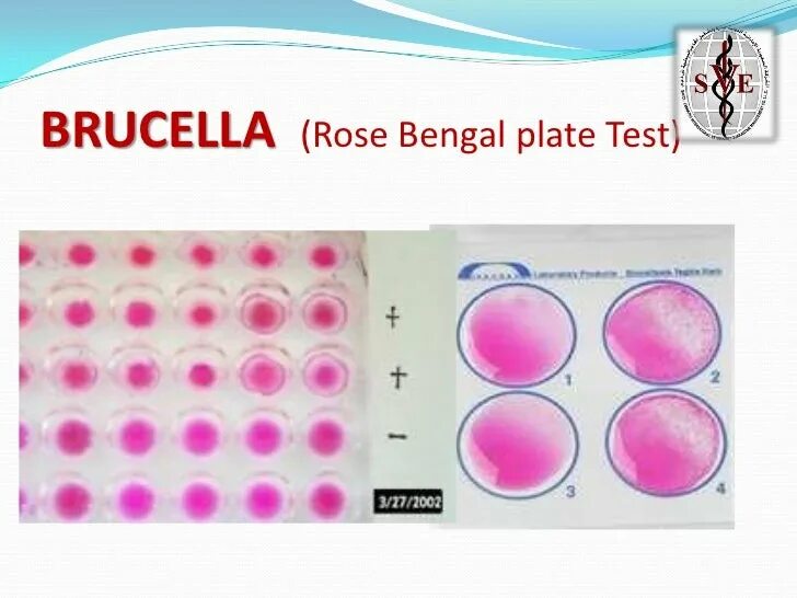 Кольцевая реакция. Розбенгал проба на бруцеллез. Роз бенгал проба на бруцеллез. РБП бруцеллез. Роз бенгал проба — РБП.