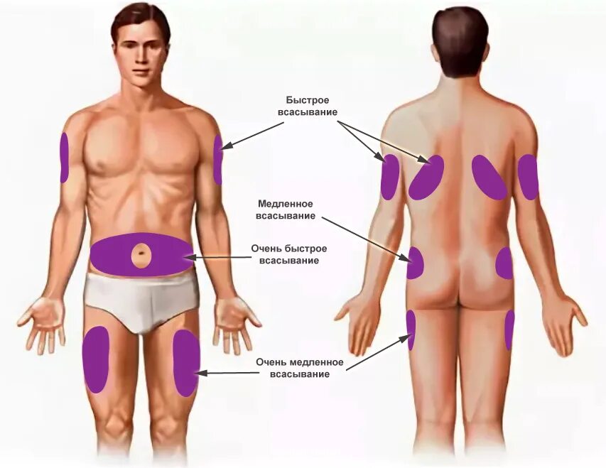 Где можно колоть. Переднебоковая поверхность бедра укол. Наружная поверхность плеча область подкожной инъекции. Техника подкожной инъекции в подлопаточную область. Внутримышечная инъекция в бедро место инъекции.