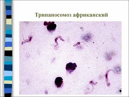 Африканский трипаносомоз