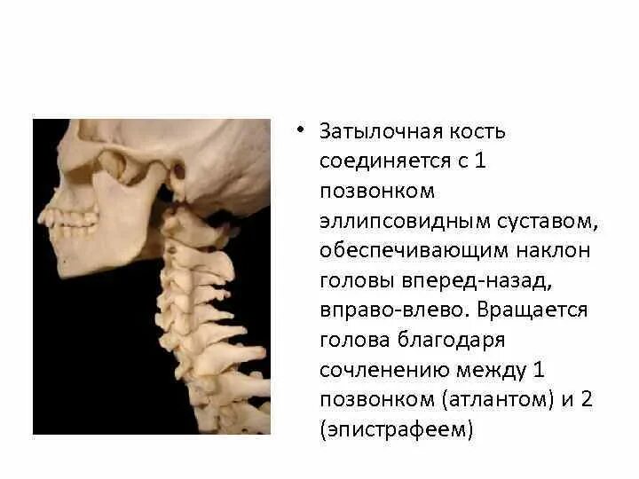 Соединение Атланта и затылочной кости. 1 Позвонок. Первый шейный позвонок и затылочная кость. Атлантозатылочный сустав строение.