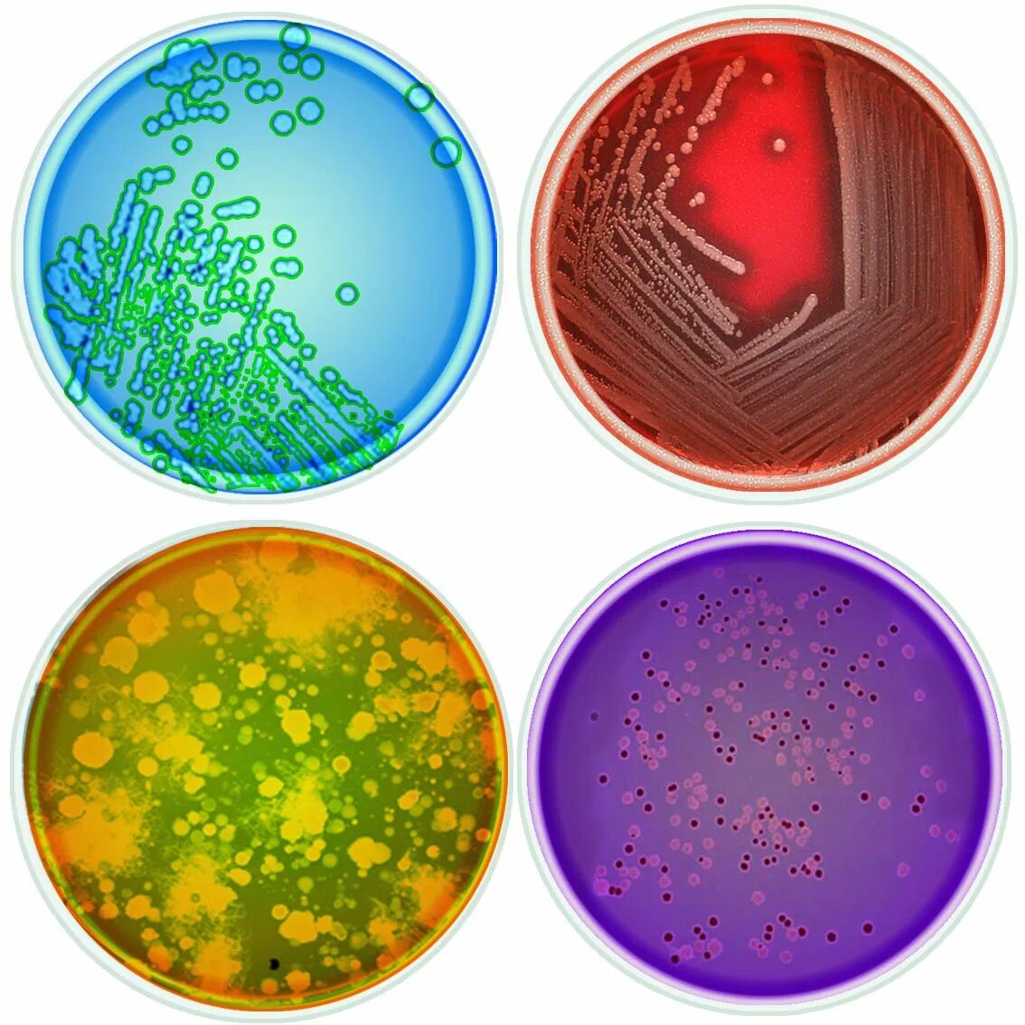 Бактерии в жидкой среде. Чашка Петри. Рост бактерий в чашке Петри. Чашка Петри с питательной средой. Чашка Петри с бактериями.