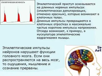 Эпилептическая активность