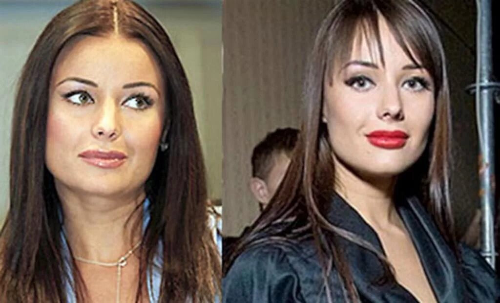 Федорова до и после пластики фото Улыбаться опасно: 10 звезд, чьи пластические губы вызывают смех и ужас Хорошие ф