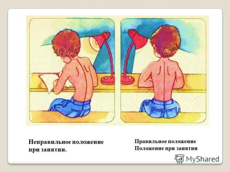 нарушение осанки и сколиоз у детей. ребенок неправильное положение. правильная осанка. нарушение осанки у студентов. аномальные предлежания плода.