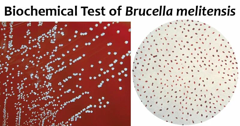 Brucella spp. Бруцелла melitensis. brucella melitensis морфология. brucella melitensis под микроскопом. brucella melitensis микробиологи.