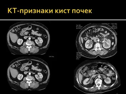 Кт почки с контрастом сколько по времени