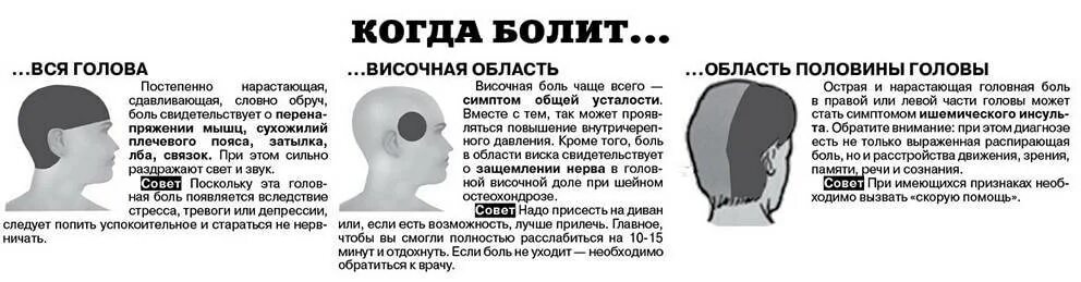 Болит голова с левой стороны сзади. Болит левая сторона головы причины. Височная головная боль. Болит голова в висках