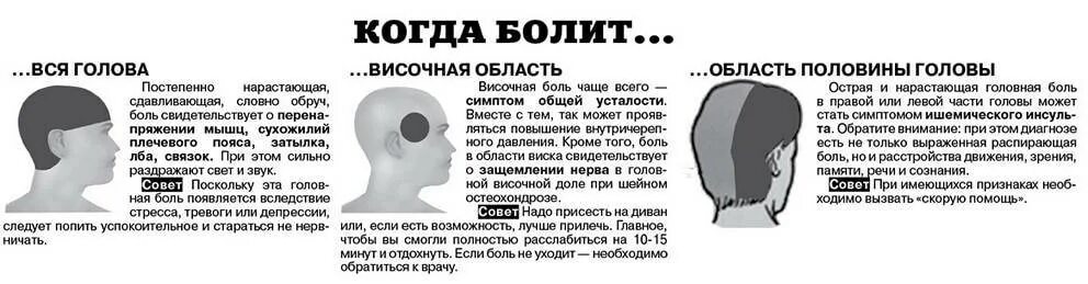 Скрип в голове. Болит левая сторона головы причины. Болит голова в висках. Головная юоль в вичках. Болит в висках причины.