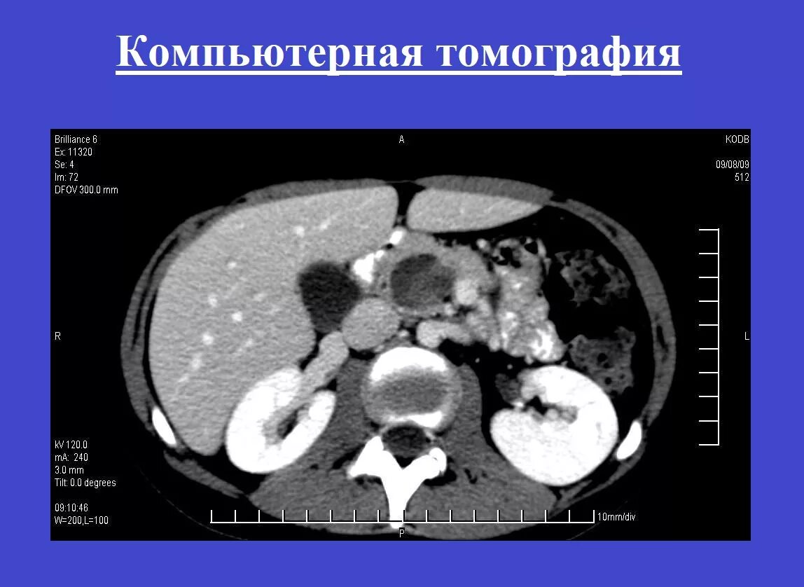 Что показывает кт