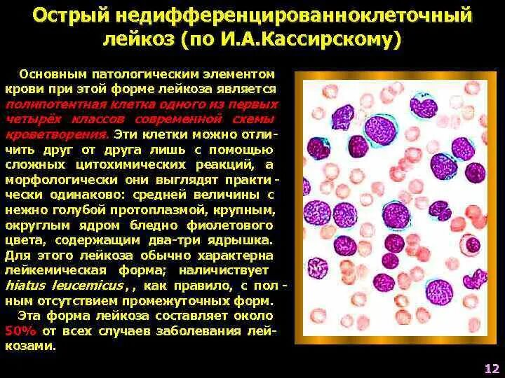 Острый лейкоз сколько живут