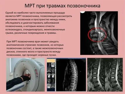 Можно делать мрт после шунтирования
