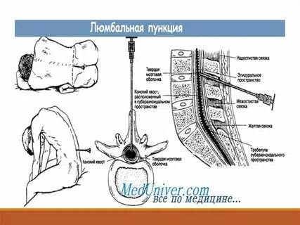 После пункции что делать