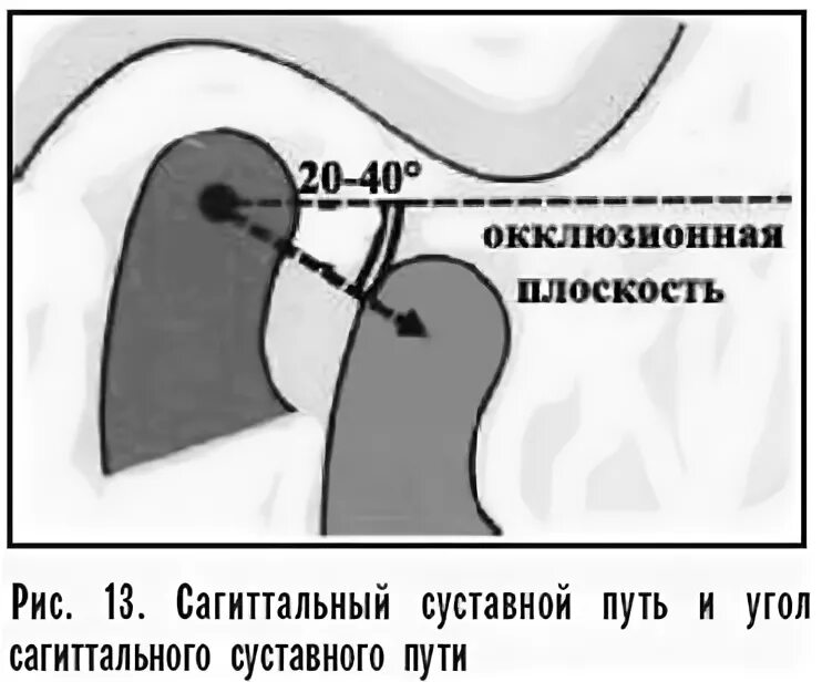 Угол путь. Угол наклона окклюзионной плоскости. пути движения нижних резцов. вертикальный суставной угол. окклюзионная плоскость точки.
