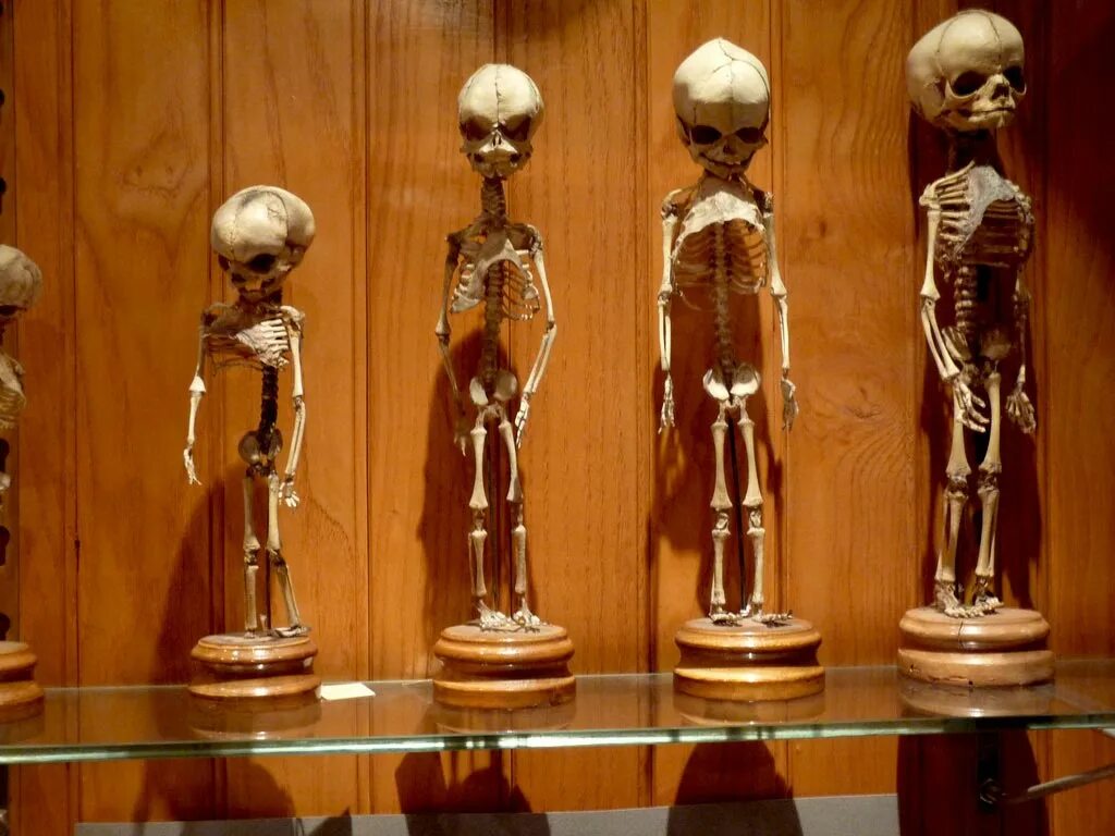 Музей имени мюттера. Музей муттер в филадельфии. Музей мюттера. Медицинский музей мюттера, филадельфия. Город филадельфия, пенсильвания.