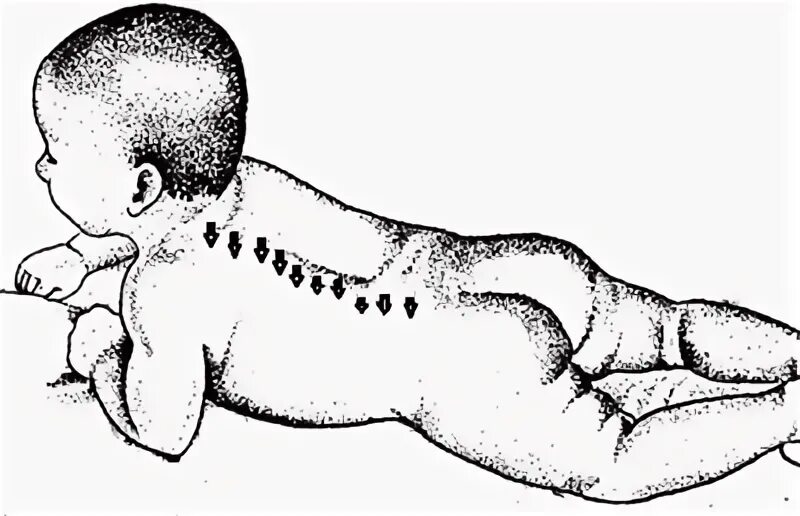 Лабиринтный тонический рефлекс. Рефлекс галанта у новорожденных. Рефлекс голанда у новорожденного. Лабиринтный тонический рефлекс. Рефлекс галанта у новорожденных.