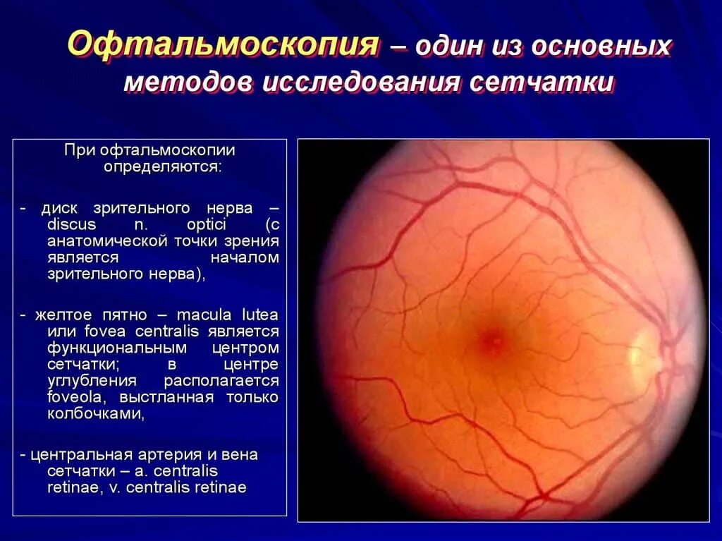 Офтальмоскопия что это. Диск зрительного нерва сетчатки. Офтальмоскопия глазного дна. Офтальмоскопия глазного дна норма. Офтальмоскопия диска зрительного нерва.