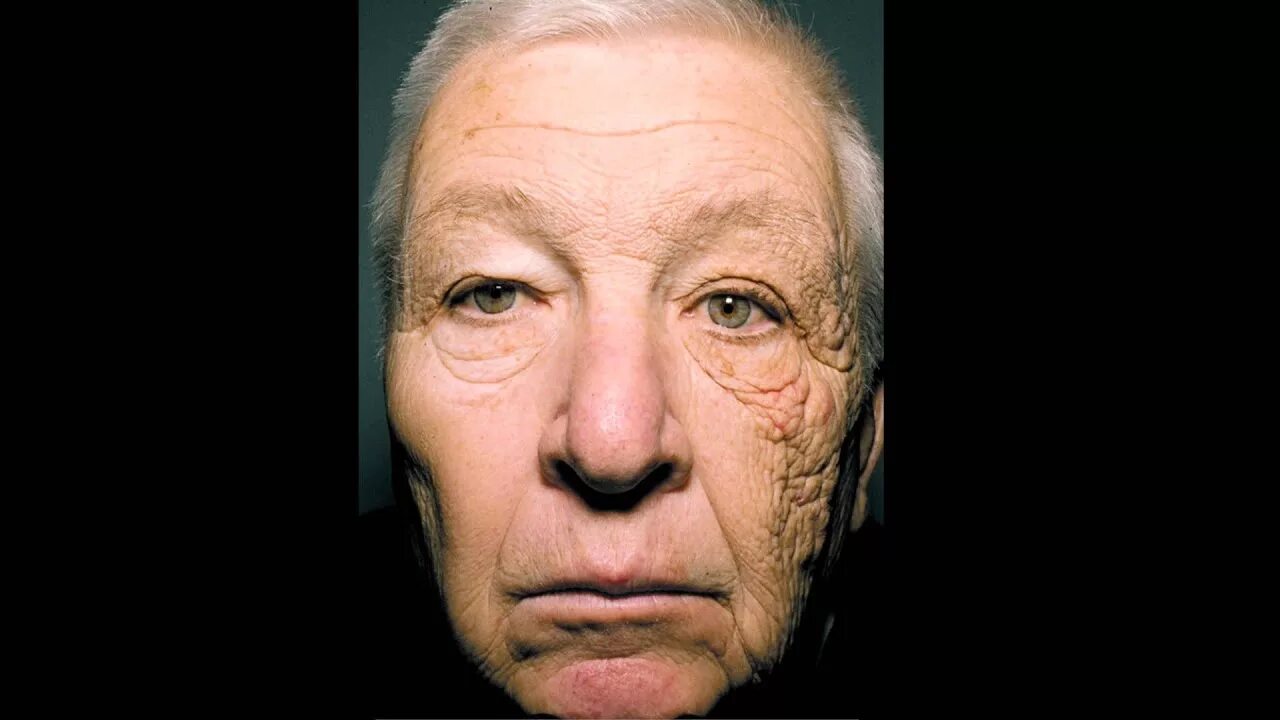 Лица нет лицо всегда. Дальнобойщик билл фотостарение. билл макэллигот. старение лица. человек с морщинами.