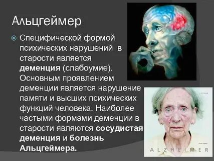 Альцгеймера по наследству
