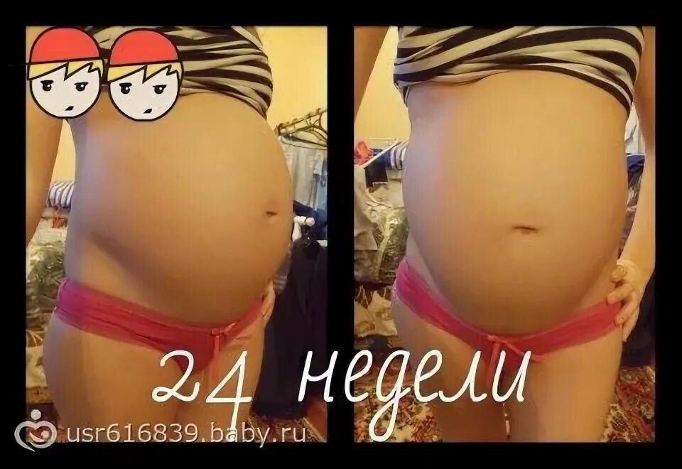 23 недели беременности двойней. Узи двойни на 18 неделе беременности. Двойня 25 неделя беременности узи. Узи двойни 20 недель фото беременности. 23 недели беременности фото плода на узи.