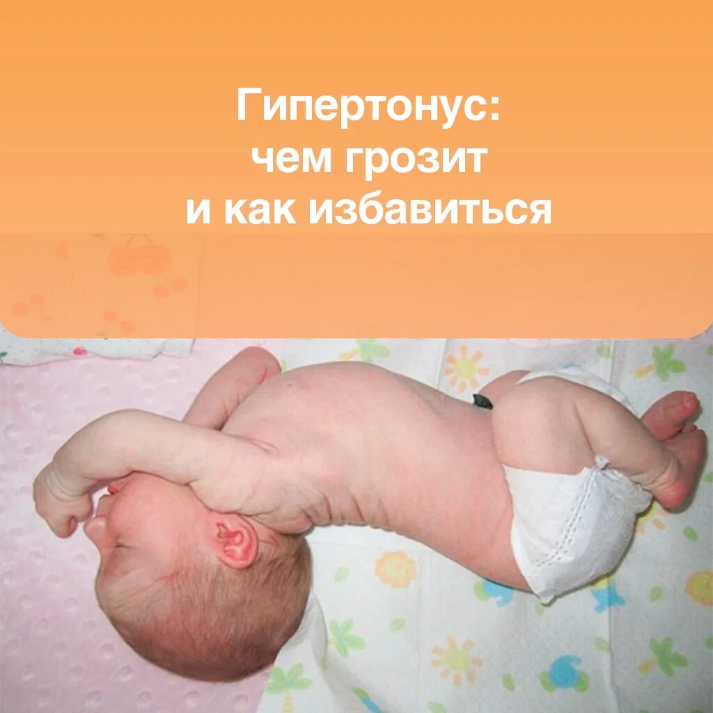 Тонус у месячного ребенка. Гипертонус мышц у грудничков. мышечный гипертонус у новорожденного. гипертонус у младенцев симптомы 3 месяца.
