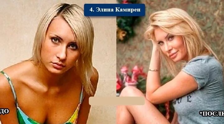 Дом 2 28.06 2025 после. Камирен дом 2 до и после пластики. участники дом 2 до и после пластики. звезды дома 2 до и после пластики. участницы дом 2 до пластики.