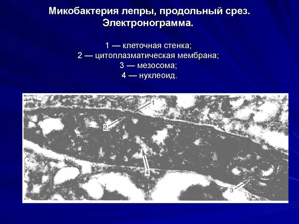 Метод продольных