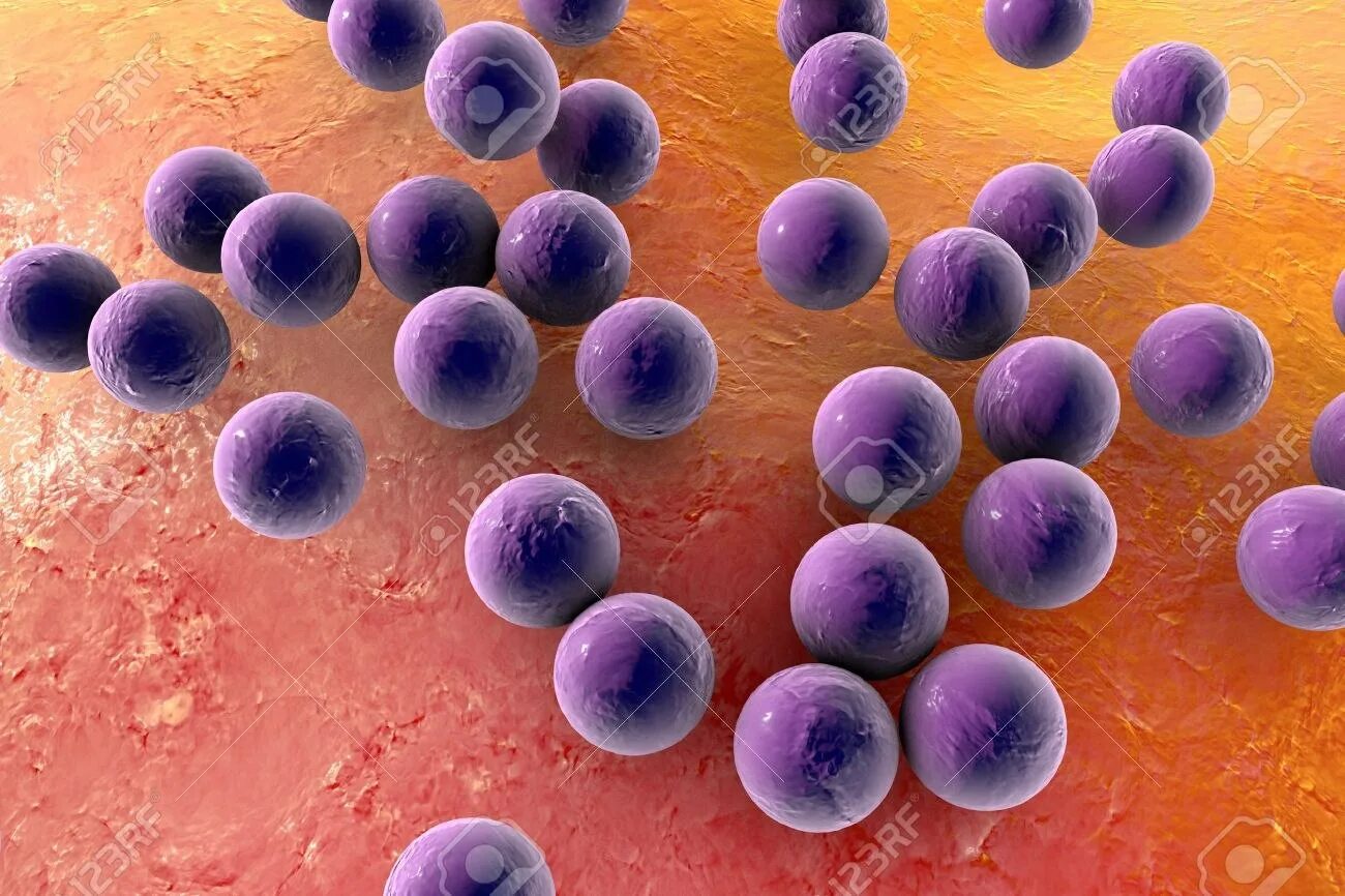 Staphylococcus aureus 5. Золотистый стафилококк MRSA. Бактерия золотистый стафилококк. Пневмококк золотистый стафилококк.