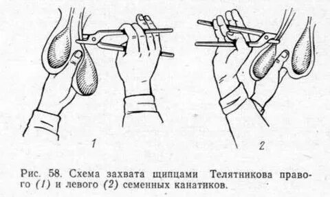 Чем отличается кастрация
