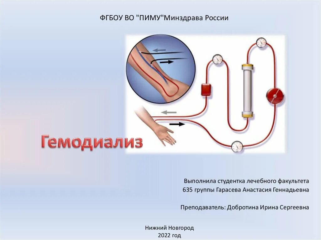 Давление при гемодиализе