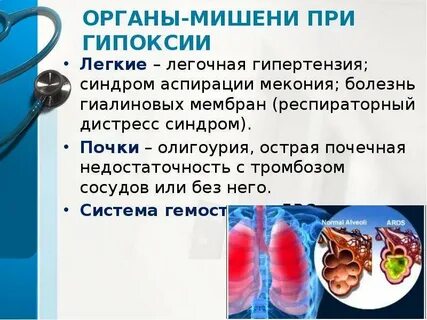 Дыхательная гипоксия