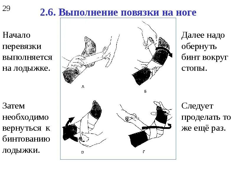 Перевязка чистой раны алгоритм. Повязки на конечности. Наложенная повязка на конечность. Повязка на конечности алгоритм. Наложение повязки на конечность алгоритм.