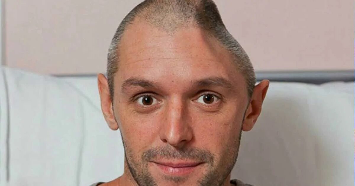 Башки нету