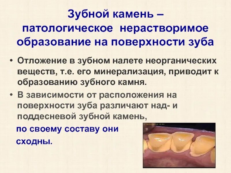 Значение зубного налета. Состав зубного камня биохимия. механизм образования зубного камня. зубной какамекакамень. формирование зубного камея.
