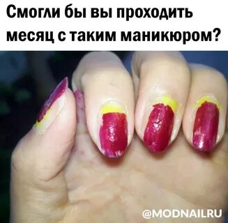 Некрасивые ногти