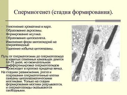 Гаплоидные сперматиды