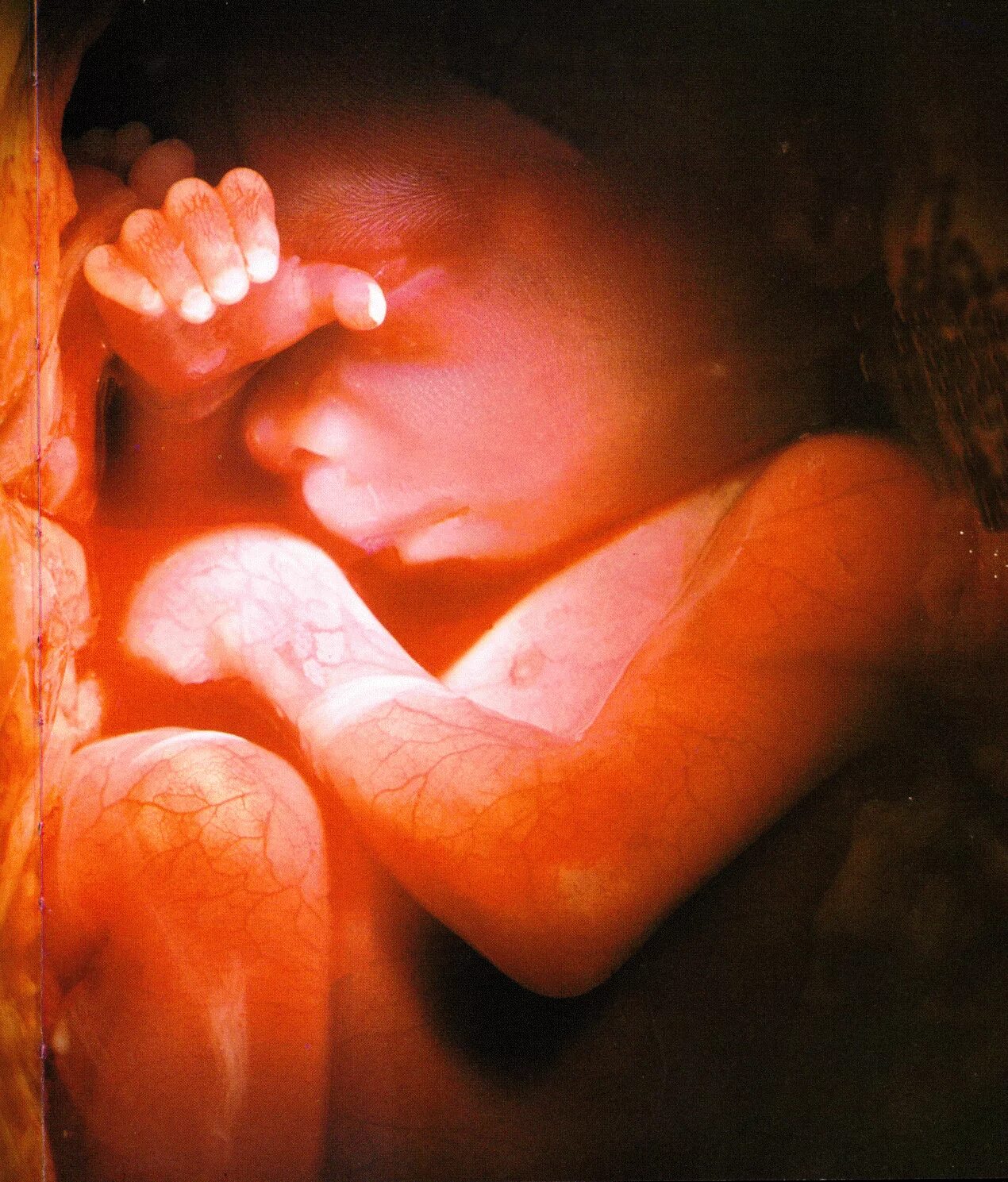 Плод ребенка. Ребенок в утробе 7 месяцев. 37 недель мальчик